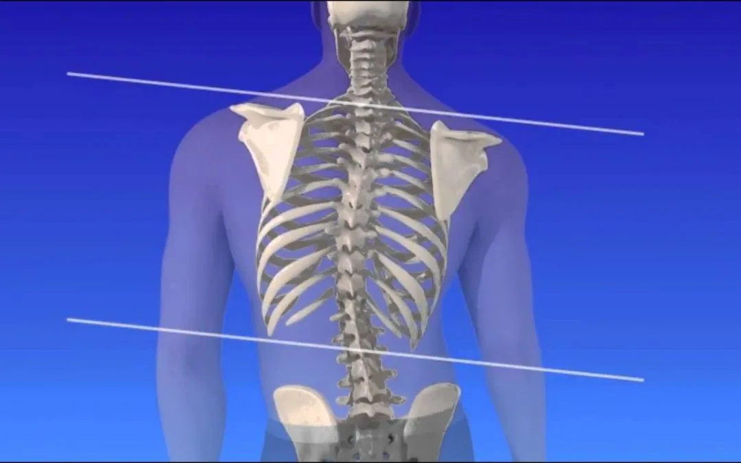 ejercicios para escoliosis